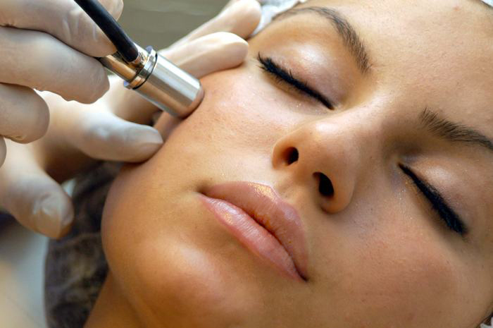 Dermabrasion for acne scar